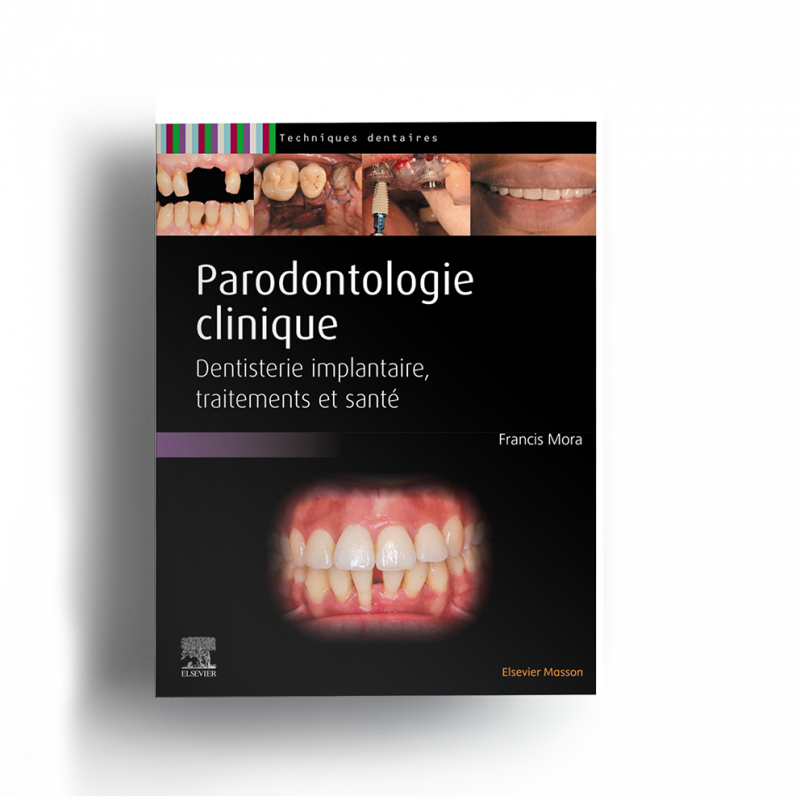 Parodontologie clinique